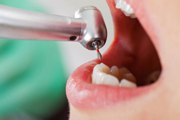 Best Emergency Dentist for Knocked-Out Tooth in Steelton, PA